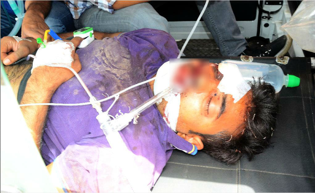monkeys attacked medical student in SN Hospital Agra