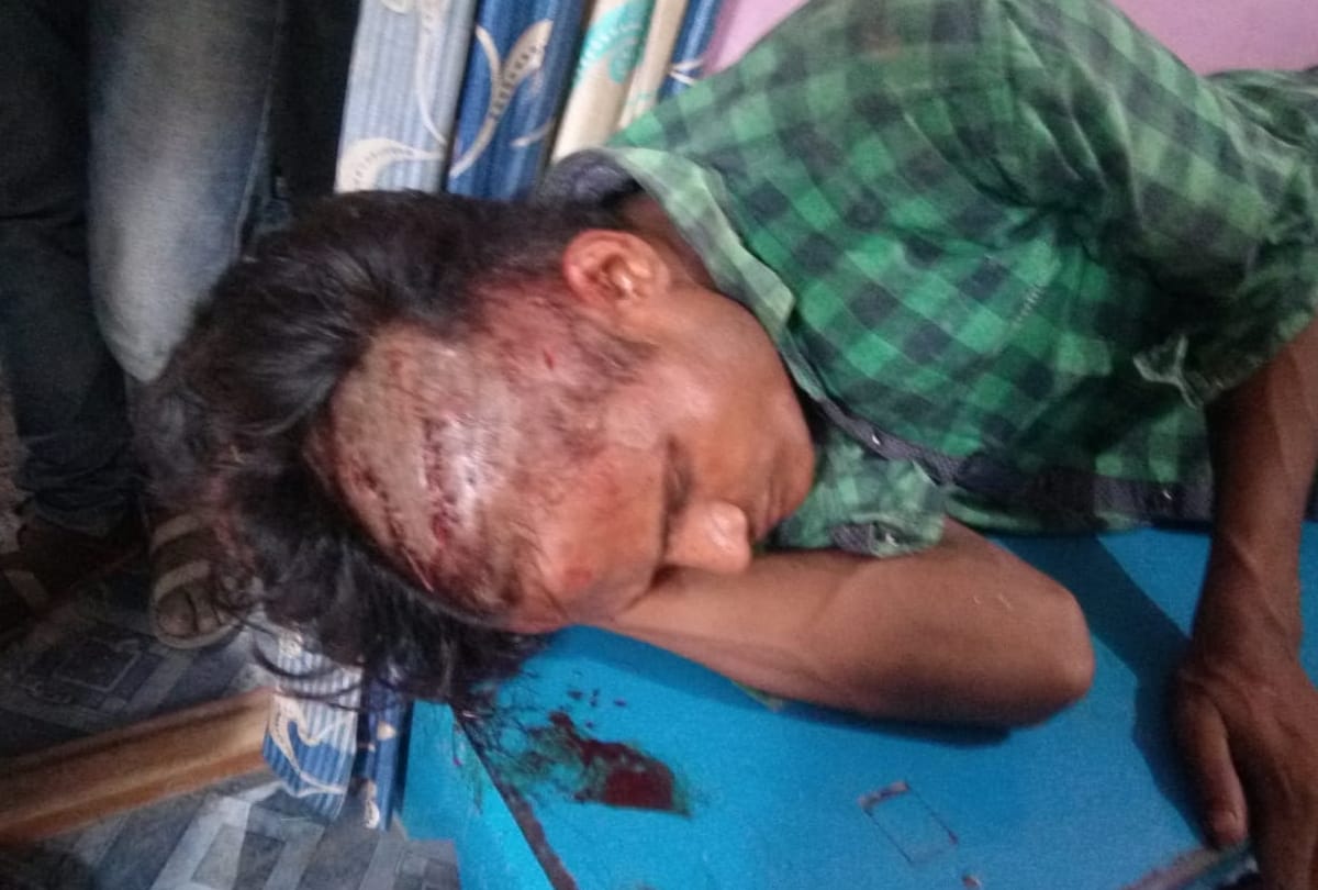 villagers killed leopard and then burn it in bahraich