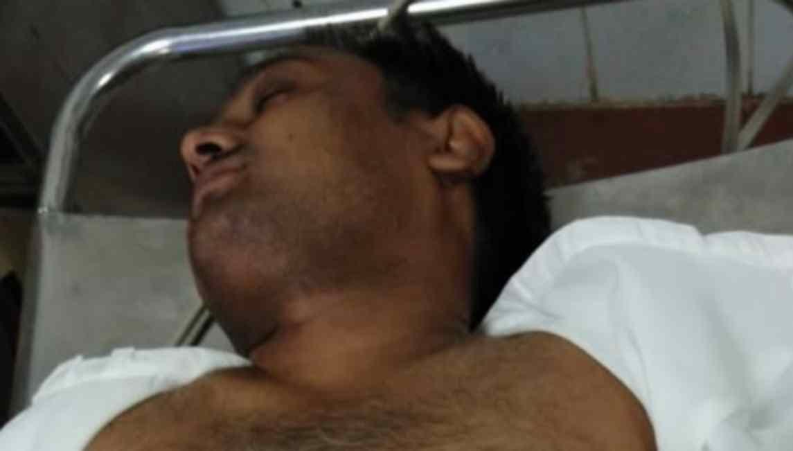 Criminal gun shot on policeman in chandauli