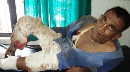 UP encounter, police officer shot the accused and injured him