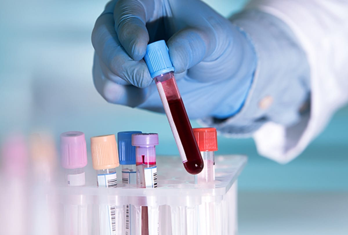 National Health Mission: Free Pathology test facility started in 39 hospitals of Uttarakhand