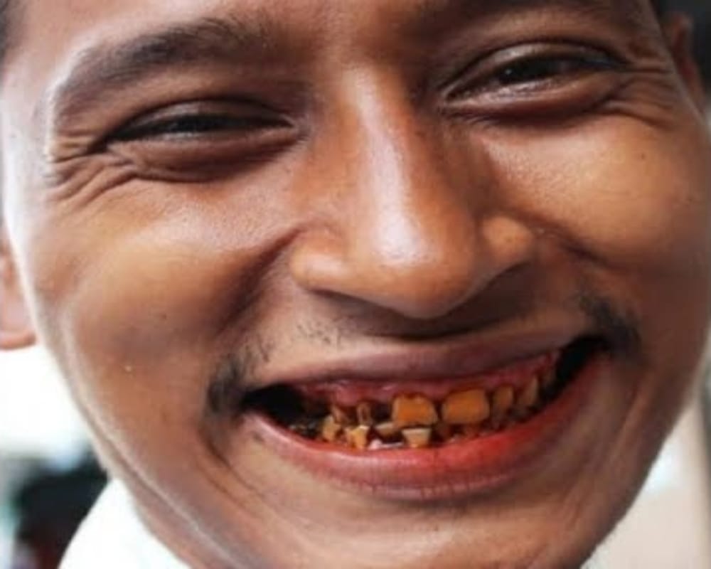 If Tobacco eating blacken your teeth then this home remedy will help to revive its colour back