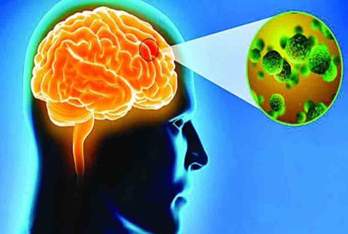 Be careful, Japanese encephalitis reached unnao
