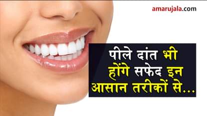 how to whiten your teeth