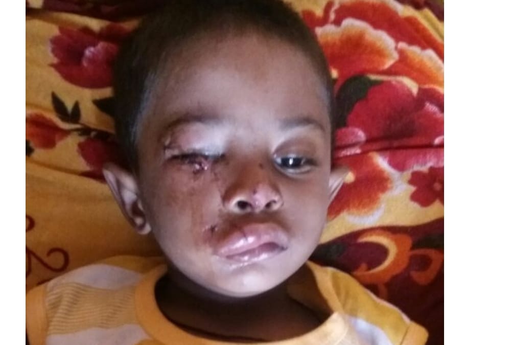 A father could not get treatment for his injured son in kgmu.