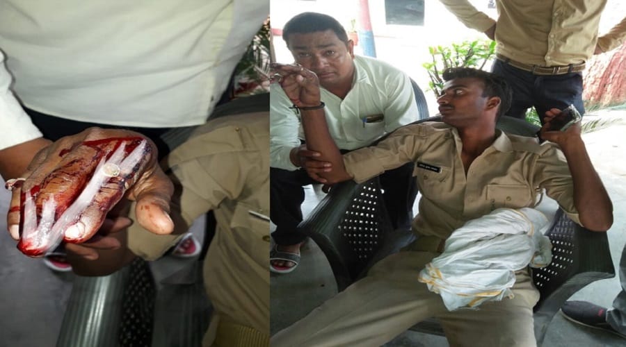 UP: attacking of Forest department team, many serious including Daroga