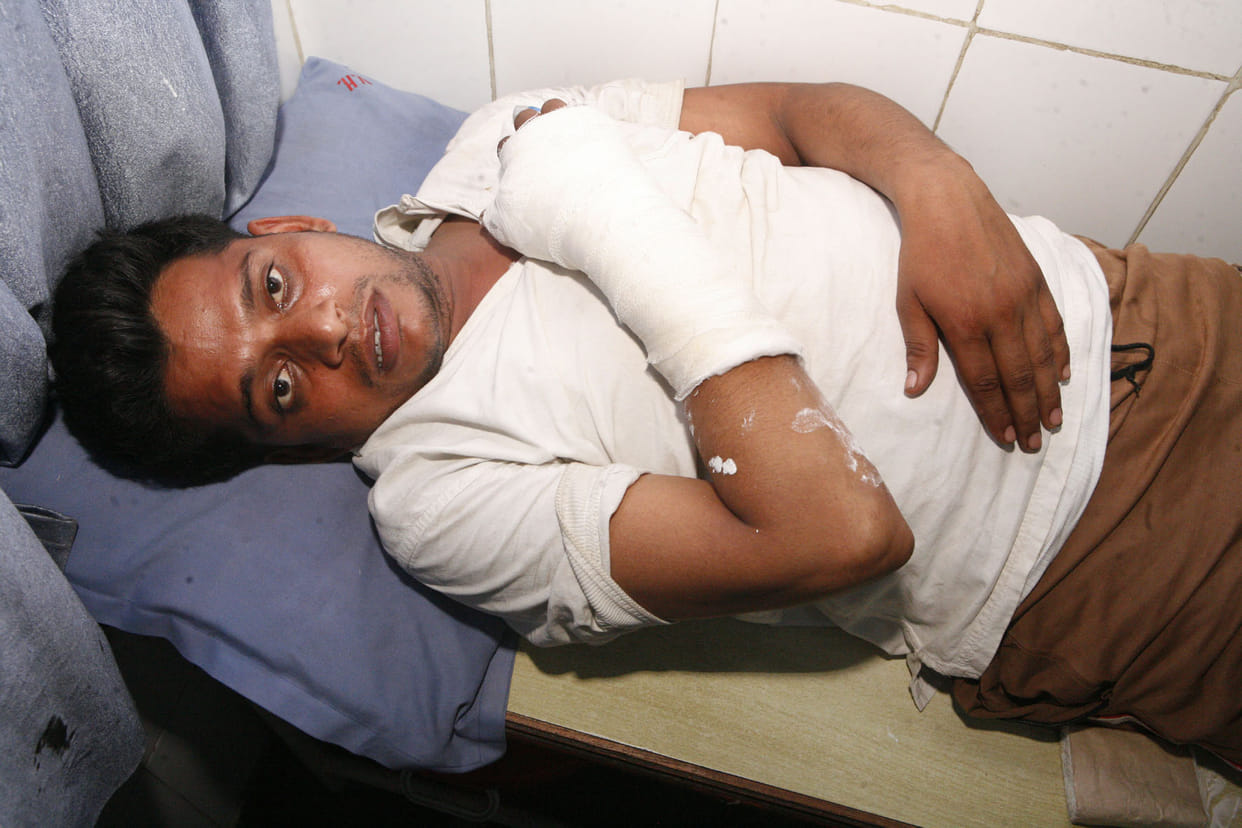 Fracture on the jump from the roof, police accused of attack