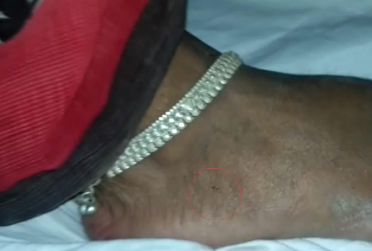 Snake bites the woman in bahraich