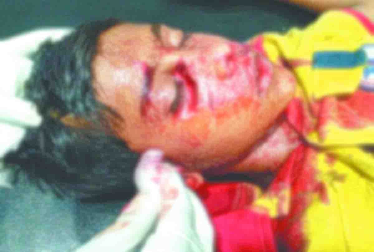 Street Dogs attacked on child in kanpur