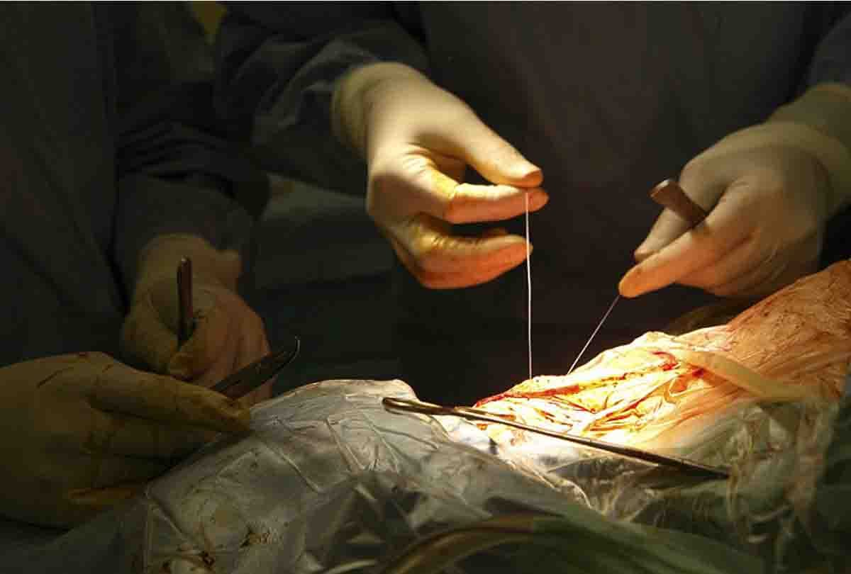 Part of Brain Sneaks Into Mans Ear, Doctor Shocked in Chennai 