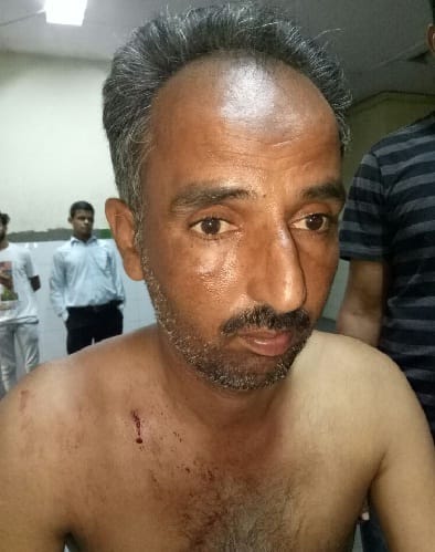तस्करों ने प्लांटेशन वाचर को सीने में मारी गोली