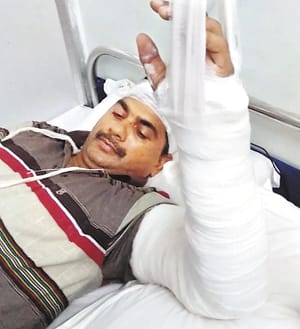 Attacking the police for the robber, Dowoga severe