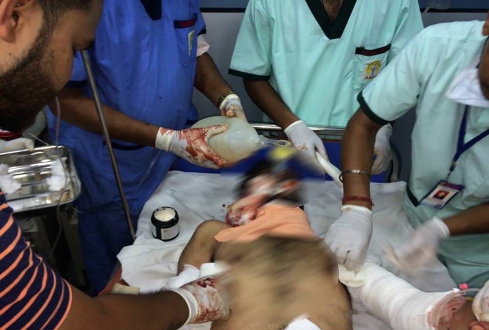 AC compressor blast in hospital three people burnt badly in haldwani
