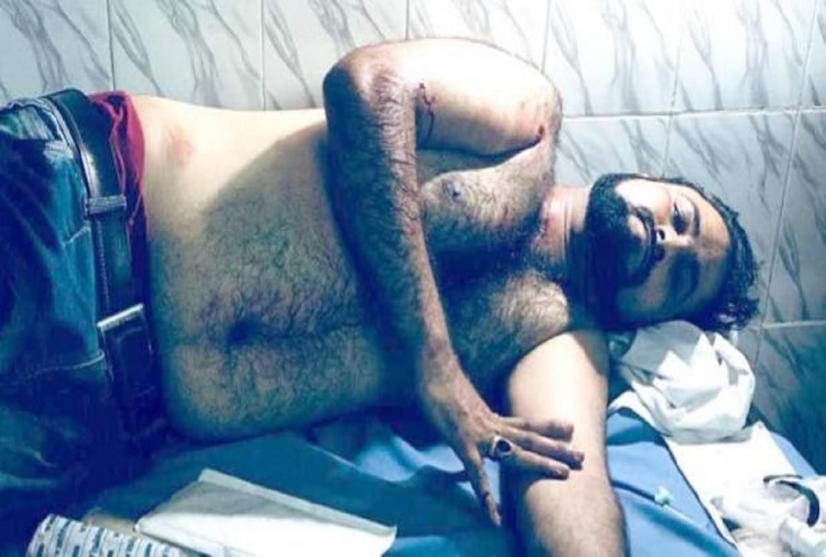 Gorakhpur: Dr Kafeel Khan brother shot at by two unidentified bike-borne miscreants in Durgabadi