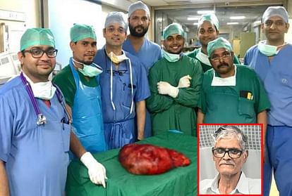 sir ganga ram hospital operated 2 feet long 10 kilogram abdominal tumor from 62 year old patient