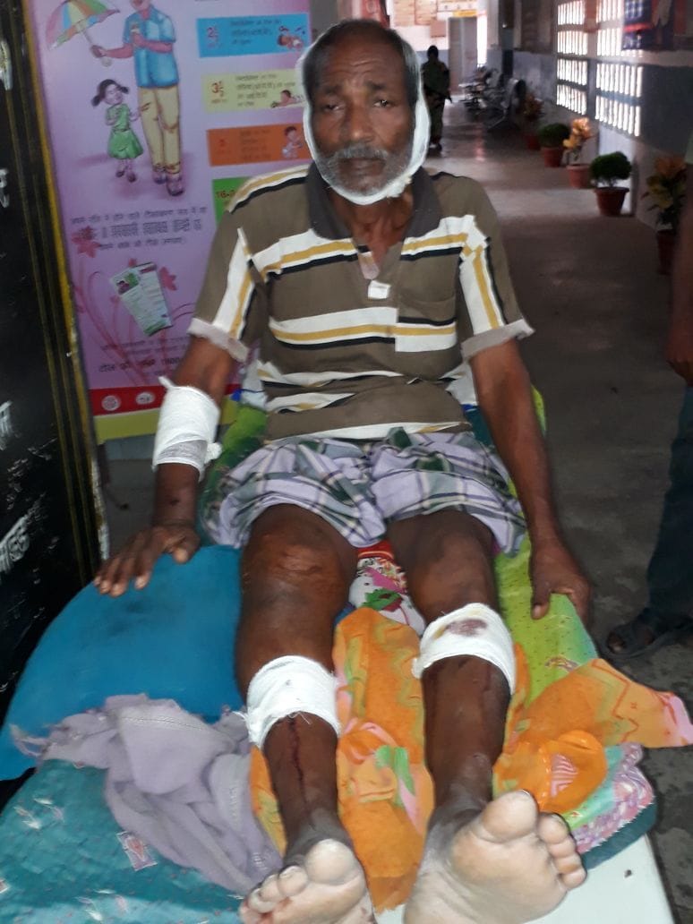 घर के बाहर सो रहे शख्स पर हमला, फायरिंग का आरोप