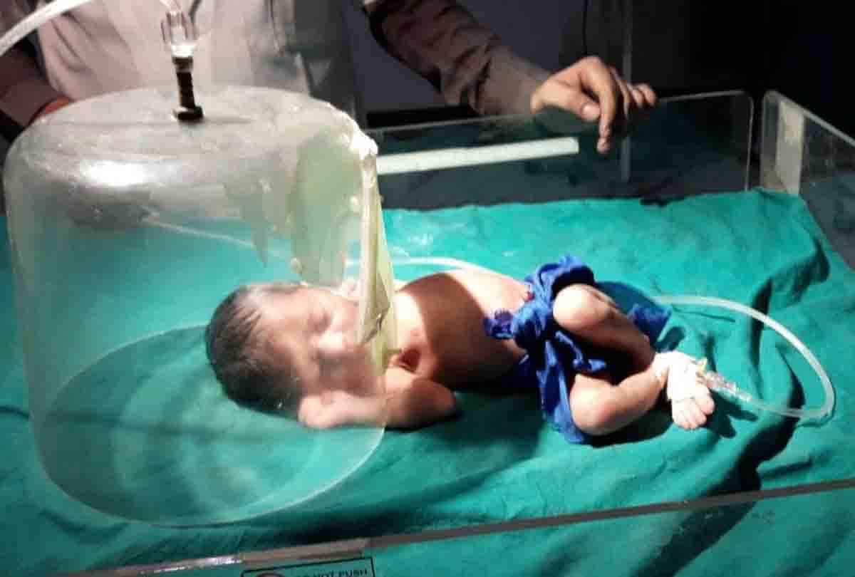 Newborn girl thrown in forest
