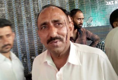 Canter Union controversy Parwanoo Bloody conflicts in both groups
