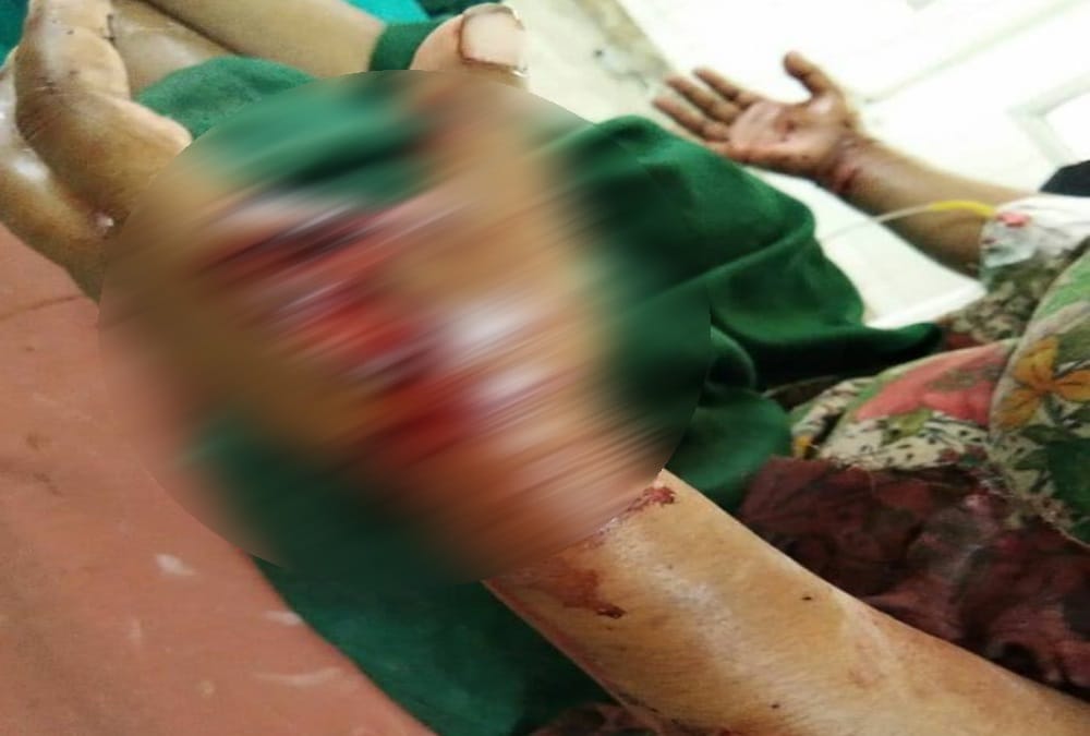 Leopard Died after attack on women in srinagar