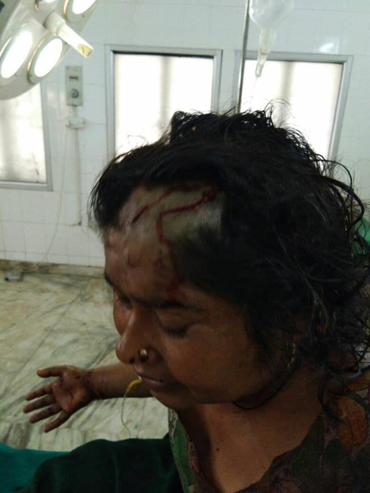 Leopard Died after attack on women in srinagar