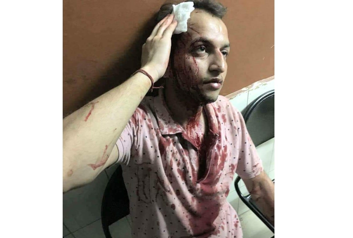 Goons attack on Ex congress MLA Ram Kumar nephew in Baddi Solan Himachal Pradesh