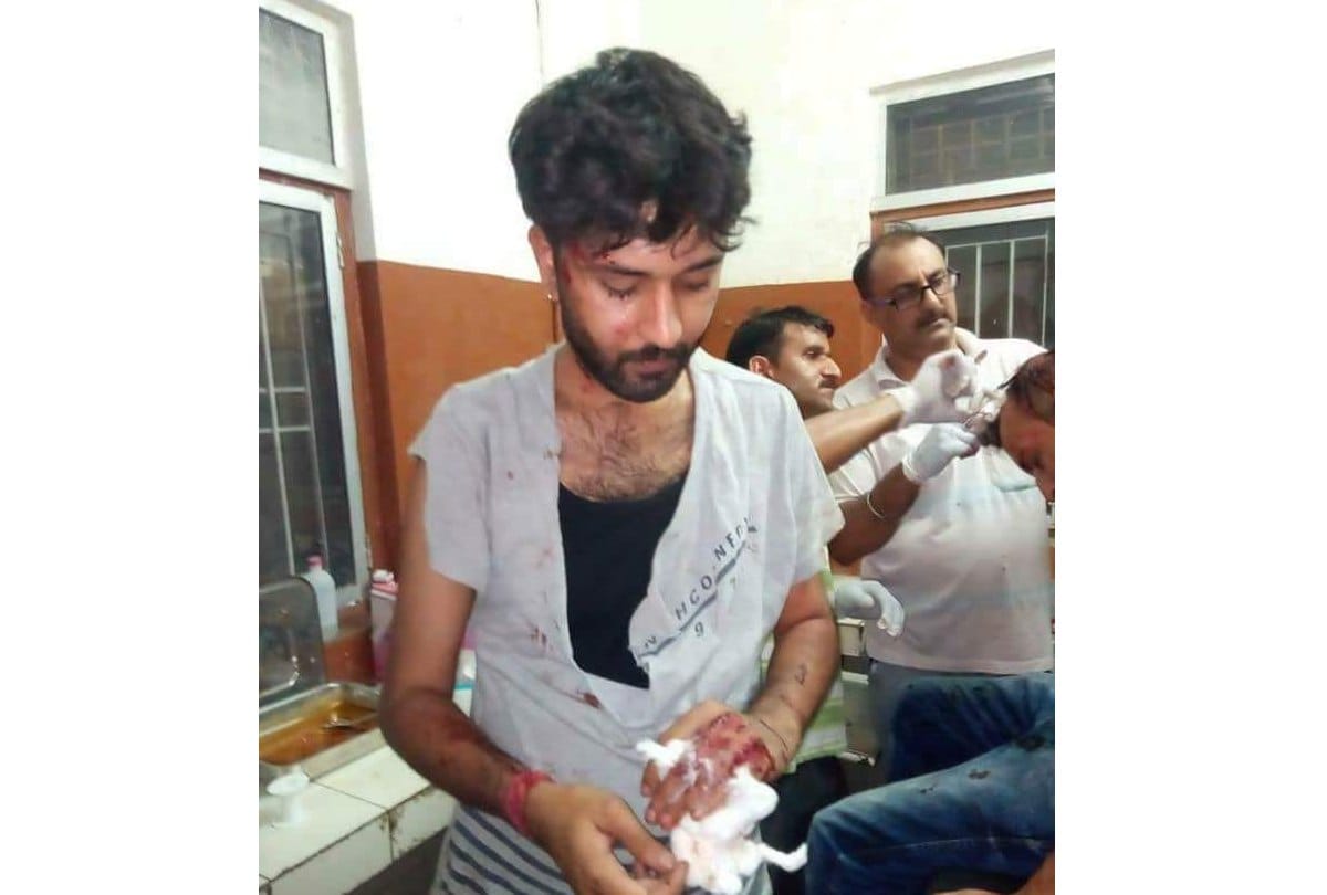 Goons attack on Ex congress MLA Ram Kumar nephew in Baddi Solan Himachal Pradesh