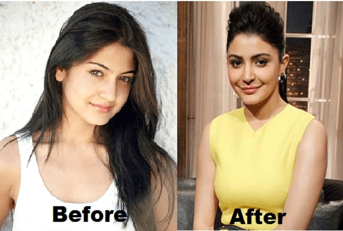 these 12 Actress Weird Look After Plastic Surgery