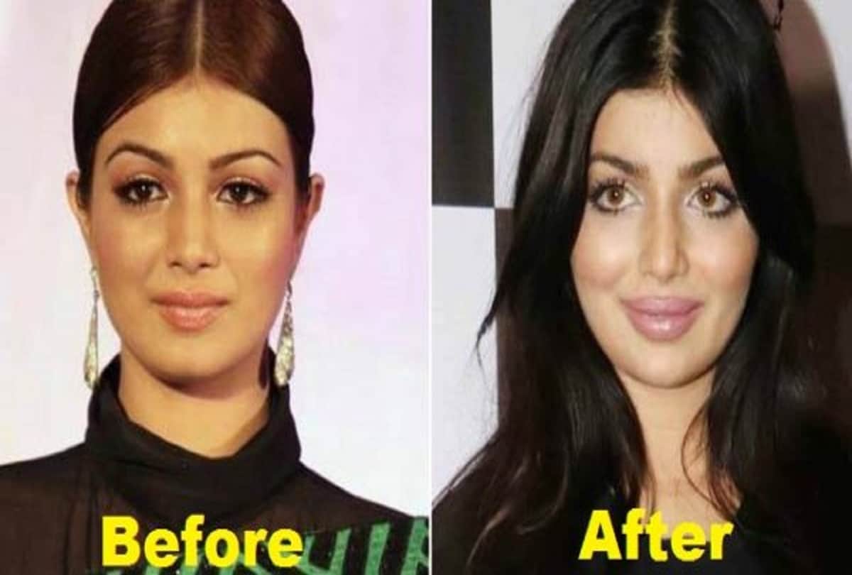 these 12 Actress Weird Look After Plastic Surgery
