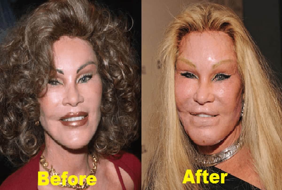 farhan abraham to lil kim all stars look ugly after plastic sugery