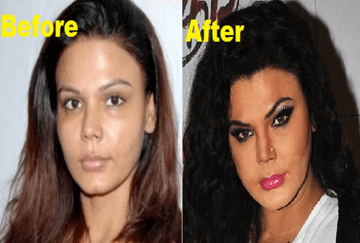 these 12 Actress Weird Look After Plastic Surgery
