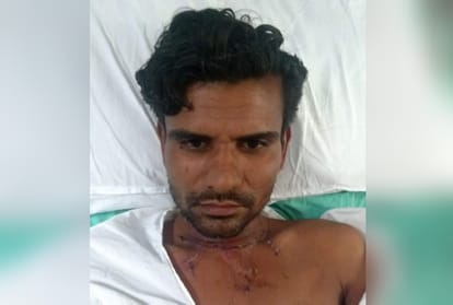 amar ujala exclusive: bull breaks respiratory canal of man doctor operated bring back voice