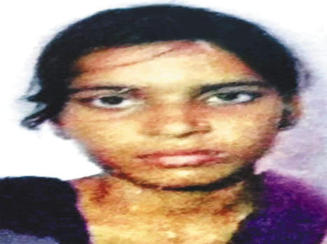 girl killed in road accident, uncle seriously