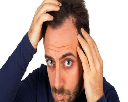 baldness
