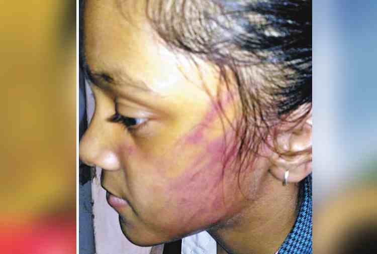 wife and 12 years old daughter beaten by husband in pinjore, panchkula