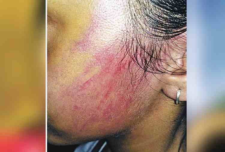 wife and 12 years old daughter beaten by husband in pinjore, panchkula