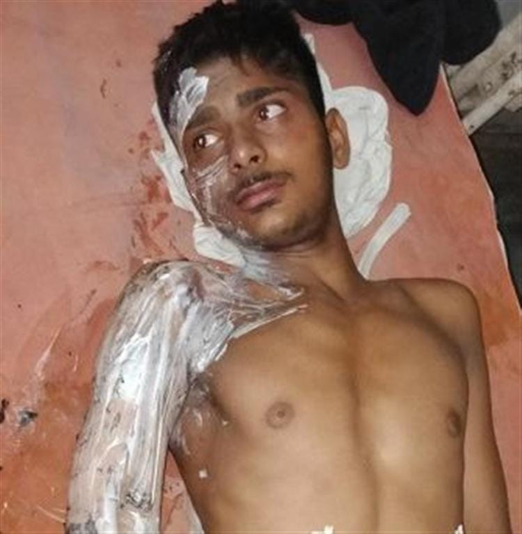 Power wire fall on bus four peoples burn in Hathras