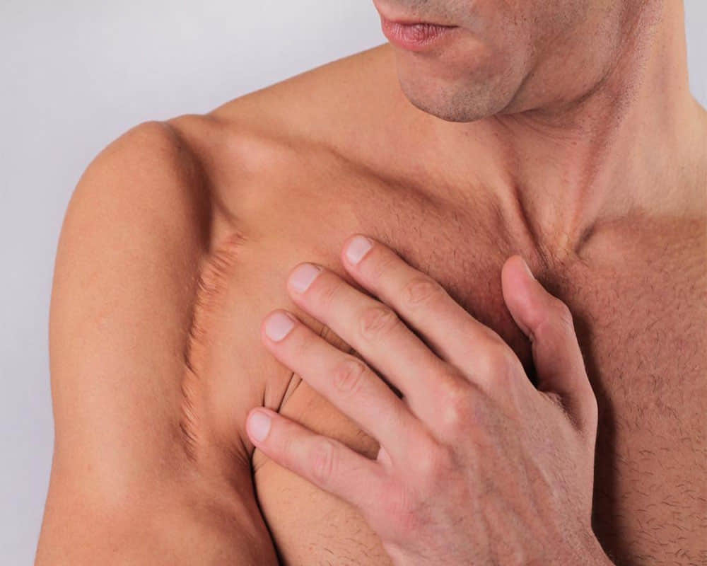 Effective natural remedies to get rid of injury scars and marks