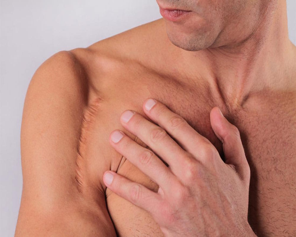 Effective natural remedies to get rid of injury scars and marks