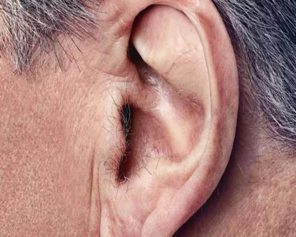 Having Hair In Your Ear Is A Warning which You Should NEVER Ignore