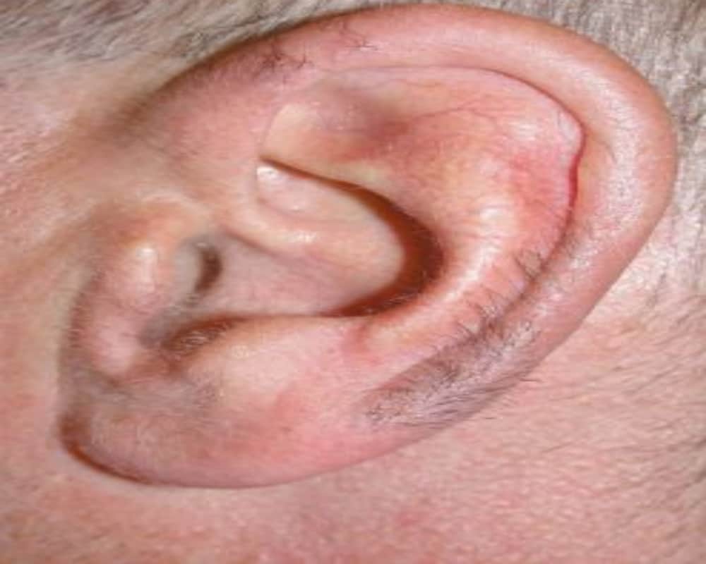 Having Hair In Your Ear Is A Warning which You Should NEVER Ignore