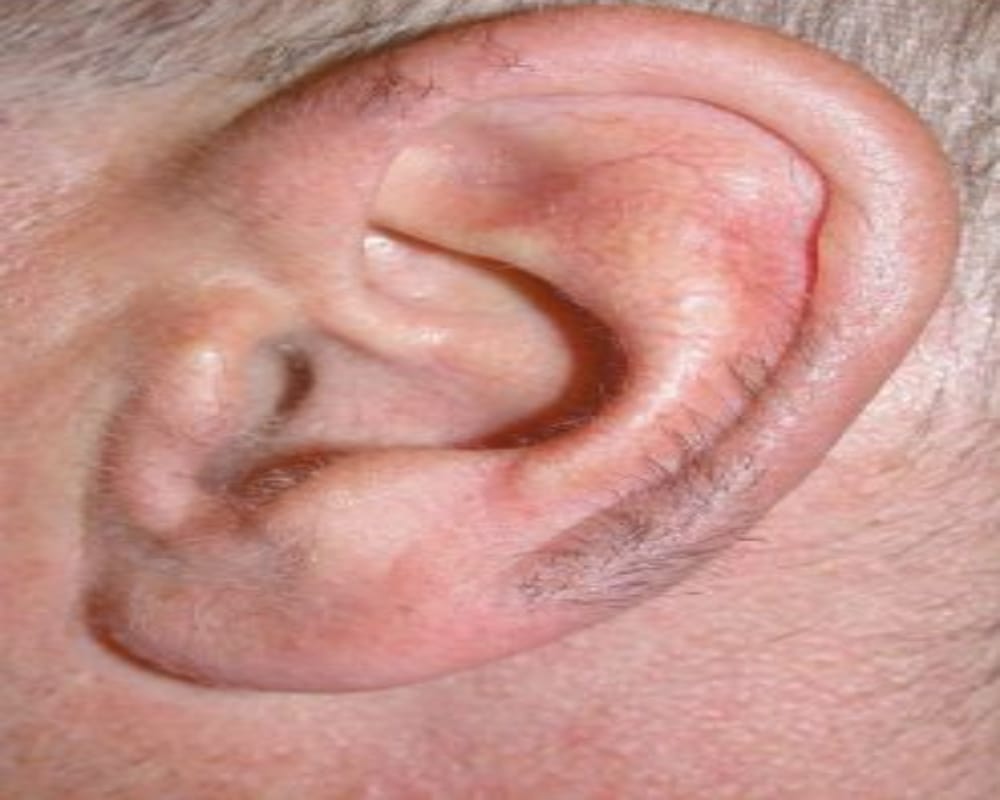 know your enemy and friend by ear shape