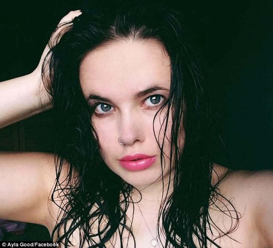  romantic candle light bath turned into horrific burns in Australia