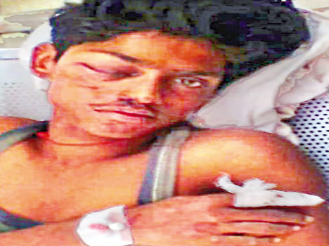 pickup ruined byke rider, young man died