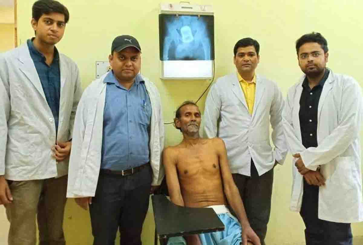 Steel glass out from patient's stomach