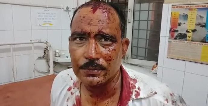 Bunker shot, wounded, robbed bike