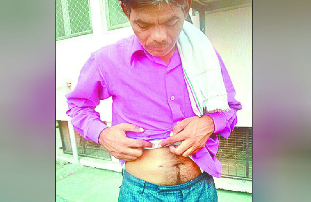 gunshot wound victim man reached at SN medical collage agra