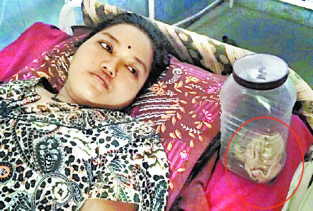 doctors left towel in woman's stomach during operation in hospital in bahraich.