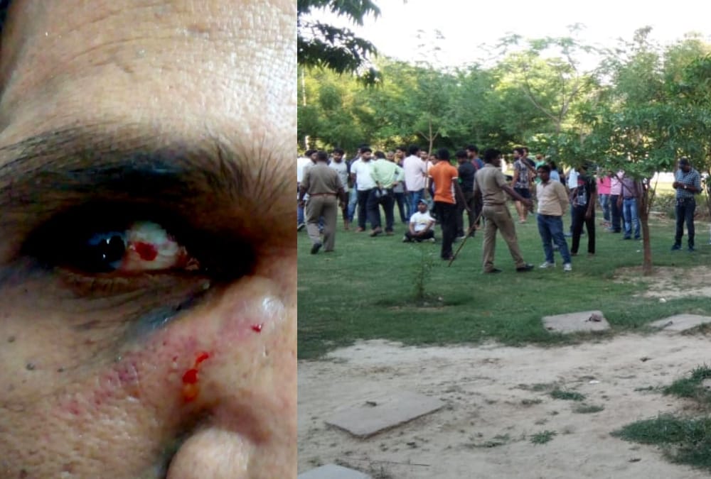 attack on teacher in baba bhimrao ambedkar university.
