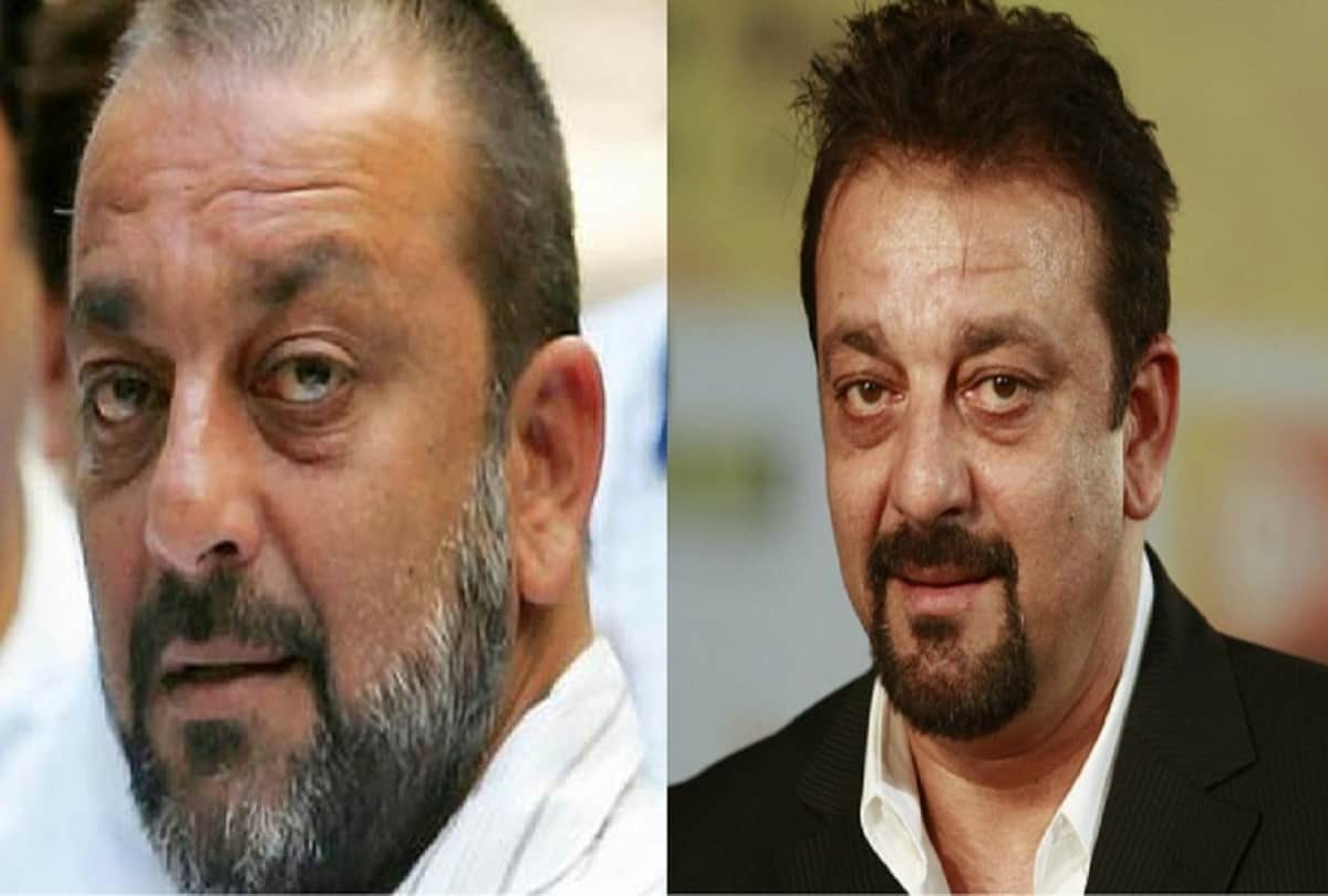 5 bollywood actors who underwent hair transplant surgery