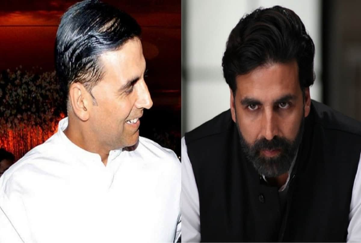 5 bollywood actors who underwent hair transplant surgery